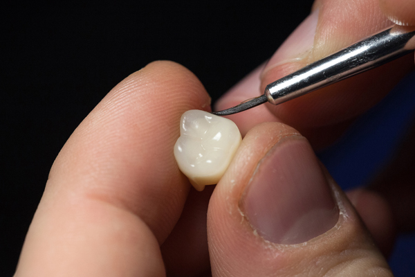 How A Porcelain Crown Can Save A Natural Tooth